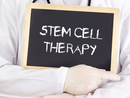 MGTA-456 Stem Cell Therapy Leads to Lasting Neurological Benefits in CALD, Data Shows