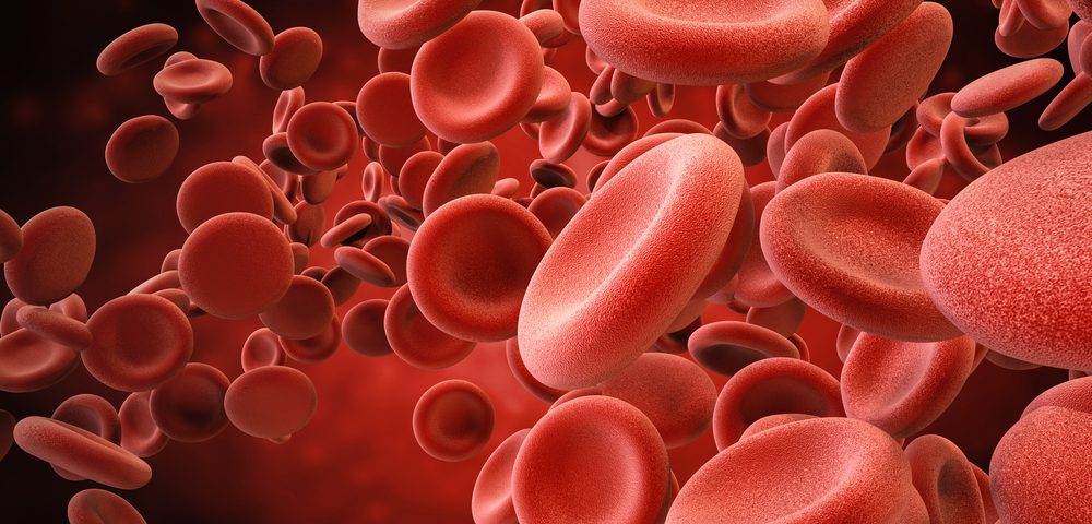 Blood Levels of 3 Biomarkers May Help Identify Newborns at Risk for X-ALD, Chinese Study Suggests